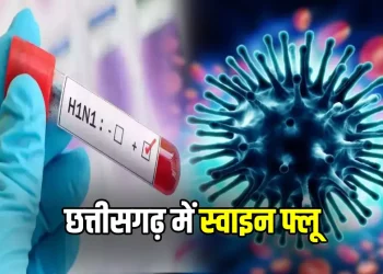 Swine Flu in CG