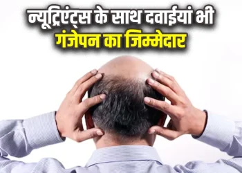 Reason Of Baldness