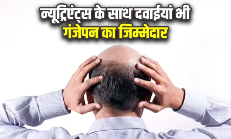 Reason Of Baldness