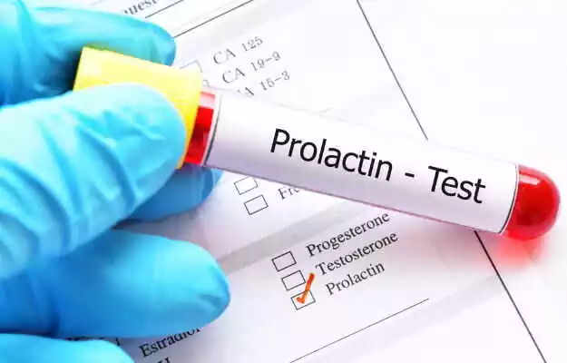 Fertility Problem prolactin range