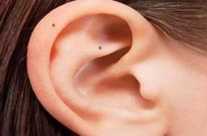 til on right ear